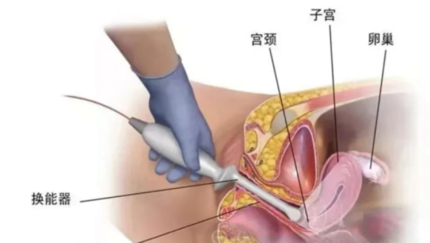数百人因天气无法乘机滞留在南极,澳门传真～澳门传真,整体规划执行讲解_破例版V1.97